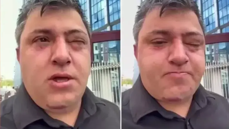 Altındağ Belediye Başkanı Tiryaki belediye işçisini darp etti
