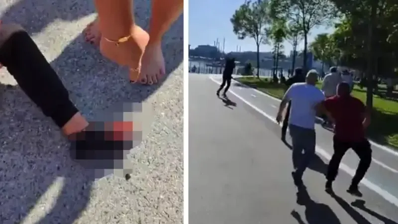 Kadıköy'de silahlı saldırıya uğradı! Sarı-kırmızılılardan açıklama