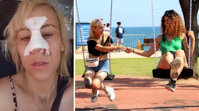 Antalya'da salıncağa binen iki genç kız, kendilerinden 'çakmak' isteyen kişinin şiddetine maruz kaldı